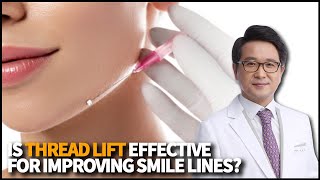 Is Thread Lift effective for improving smile lines What kind of clients should have thread lift [upl. by Vedetta]