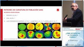 D César Villa ¿Cómo interpretar la topografía corneal [upl. by Brit172]