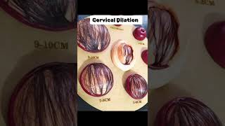 Cervical Dilation cervix cervical pregnant midwife [upl. by Cardew81]