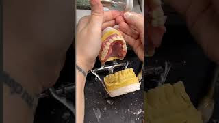 Teeth setting in prosthodontics shorts viral trending dentistry bds prosthodontics neetpg [upl. by Roper]