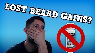 Minoxidil Beard Journey I Took A Break [upl. by Auginahs]