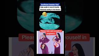 Baby unable to move due to insufficient amniotic fluid😥😥viralvideo trending viralshorts [upl. by Natka]