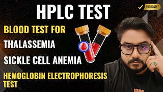 HPLC Test For ThalassemiaSickle Cell Anemia Hemoglobin Electrophoresis Test Genetic Blood Disorder [upl. by Januisz996]