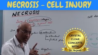 Necrosis  Cell Injury  General Pathology 🩺 [upl. by Gamal112]