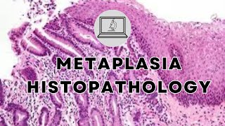 METAPLASIA  HISTOPATHOLOGY AND MORPHOLOGY [upl. by Wightman]