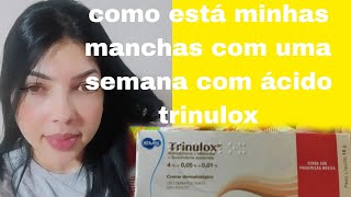 como estão minhas manchas com uma semana do ácido trinulox [upl. by Quintilla522]