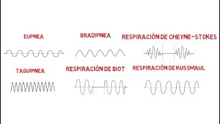 Patrones respiratorios Eupnea Bradipnea Taquipnea Biot CheyneStokes y Kussmaul [upl. by Animsaj]