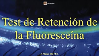 Test de Retención de la Fluoresceína [upl. by Levy376]