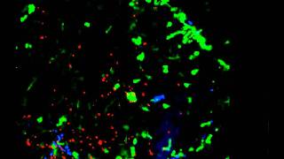 Movie 13 Directional extravasation of neutrophils from blood vessels toward the site [upl. by Ahsocin]