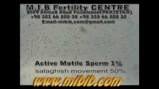 active motile sperm 1 sluggish motile 50 videolow sperm count video [upl. by Sirrad]