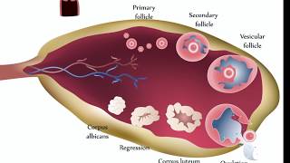 Ovarian Cysts [upl. by Aram]