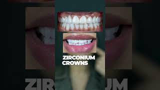 Zirconium Crowns The Ultimate Choice for Strength Beauty and a Perfect Smile [upl. by Kasey]