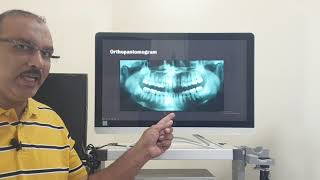 Stylohyoid syndrome Hindi Patient teaching programme [upl. by Christye492]