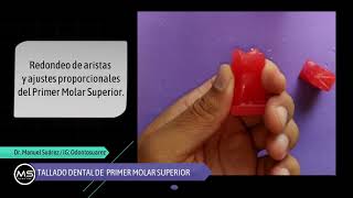 Tallado Dental UD Primer Molar Superior En Taco de cera [upl. by Hannasus]