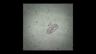 A Strongyloides spp egg in the faeces of cattle [upl. by Nave]