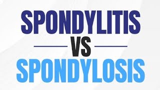 Physioinsightss spondylolysis spondylolisthesis spondylitis spondylosis [upl. by Athalee]