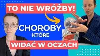 Co pokaże badanie okulistyczne Toczeń borelioza a uszkodzenie nerwu wzrokowego  O choroba [upl. by Gem]