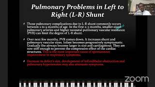 Approach to Eisenmenger Syndrome [upl. by Thema897]