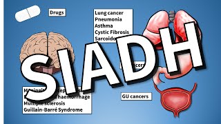 SIADH EXPLAINED Hyponatraemia [upl. by Drooff]