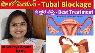 Fallopian Tubal Blockage How to Cure Best Treatment in Ayurveda UTTAR VASTI  Dr Soumya devara [upl. by Suiramad292]