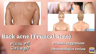 Is Body Acne your problem Products for Body Back Acne எப்படி சரி செய்வது drthamizhinian [upl. by Armyn]