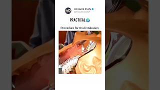 Procedure of Oral Intubation Practical  Science in Real 🌍 Life 3D Animation intubation practical [upl. by Yt]