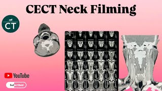 How to make filming  CECT Neck  Ge 32 revolution machine [upl. by Yntrok982]