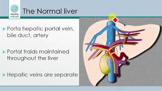 liver sonography [upl. by Annairba]