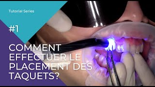 Comment effectuer le placement des taquets [upl. by Brelje]