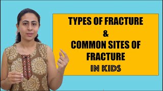 TYPES OF FRACTURES AND COMMON SITE OF FRACTURES IN KIDS [upl. by Evets]