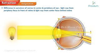 Refractive errors of eye 🌟👁️ Ophthalmology lectures [upl. by Nnail]