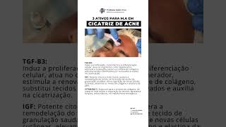 Ativos para tratar cicatriz de acne [upl. by Darda173]