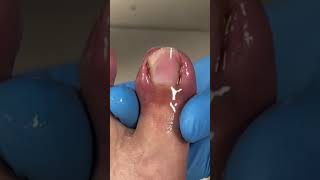 Satisfying pedicure video pedicure toenails [upl. by Granese681]