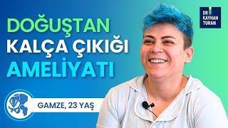 Kalça Protezi Ameliyatı Sonrası Yorumlar Gelişimsel Kalça Çıkığı Olan Gamze Anlatıyor [upl. by Ymmaj237]