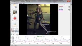 Gait Analysis protocol in Simi Aktisys [upl. by Nevetse328]