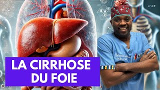 Tout ce que vous devez savoir sur La cirrhose du foie par docteursourire [upl. by Irrac]