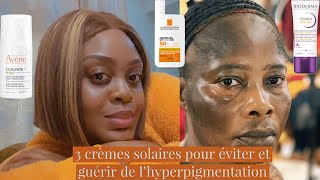 3 crèmes solaire pour éviter et guérir de l’hyperpigmentation  comment protéger sa peau des mbatas [upl. by Sophronia489]