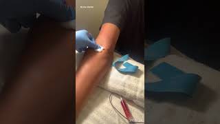 How to use Cohesive Bandage CoBand after removing an IV or Butterfly Needle [upl. by Nylrem]