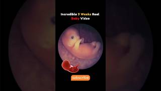 9 Weeks Baby Real Video From Womb 😍 Incredible pregnancy fetus trendingreels trendingshorts [upl. by Sokin]