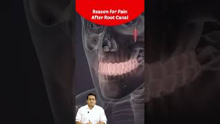 Top Reason For Pain After Root Canal Treatment  Dr Chirag Chamria  Royal Dental Clinics [upl. by Arihsa]