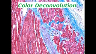 Separating colors in light microscopy images Color Deconvolution in ImageJFIJI [upl. by Jolda916]