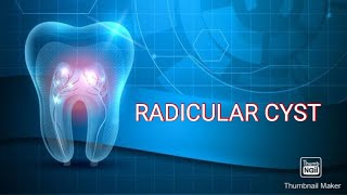 RADICULAR CYST [upl. by Aikcin]