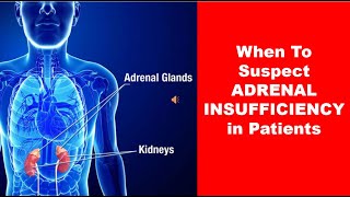 When To Suspect ADRENAL INSUFFICIENCY in Patients [upl. by Celinka]