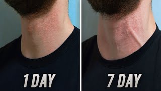 Big Neck in 7 DAYS   Home Exercise [upl. by Glynda]