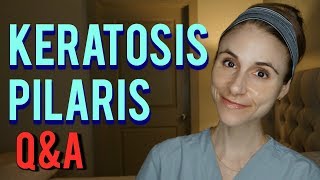 KERATOSIS PILARIS QampA WITH A DERMATOLOGIST Dr Dray [upl. by Cairns243]