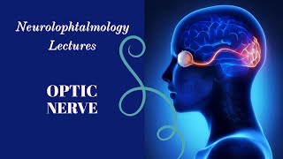 NEUROOPHTALMOLOGY lecture 5 PAPPILOEDEMA complete explanation [upl. by Adnahcal967]