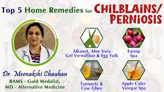 Top 5 Home Remedies for Chilblains Perniosis Natural Treatment [upl. by Navi]