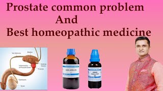 prostate Gland And Urinary Problem Homeopathic Medicine  Prostate Homeopathic Medicine [upl. by Newmann]