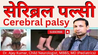 Cerebral Palsy  Dr Ajay Kumar Child Neurologist in Patna Call 7250023111 9546454005 [upl. by Sara678]