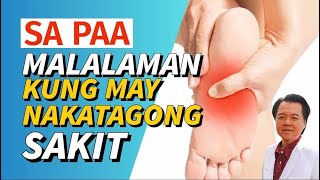 Sa Paa Pwede Makita kung may Nakatagong Sakit  By Doc Willie Ong [upl. by Naol]